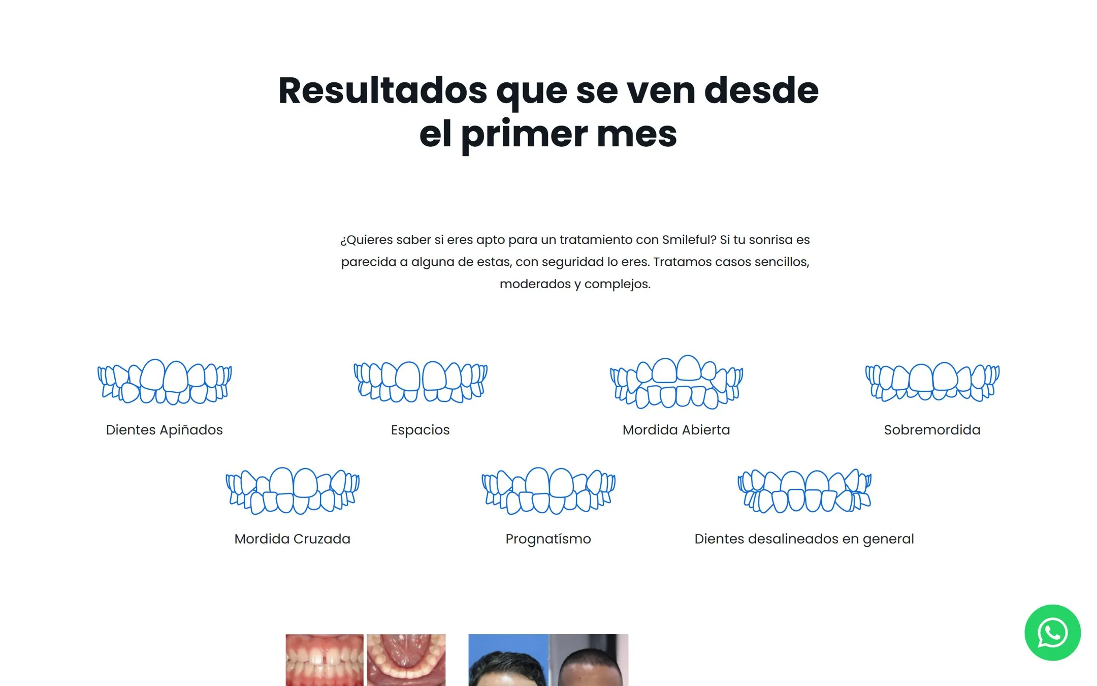 The Smileful results page with tooth icons for crowding, gaps, open bite, overbite, crossbite and prognathism